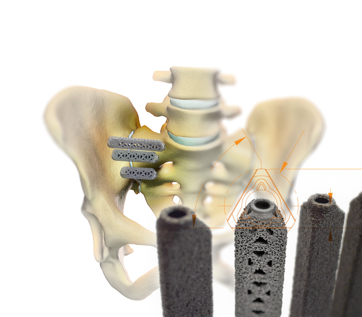 SI Joint Treatment San Juan Regional Medical Center